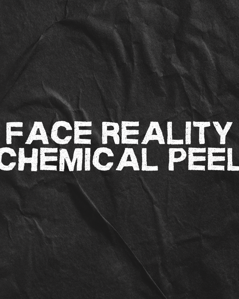 Face Reality Acne Peel