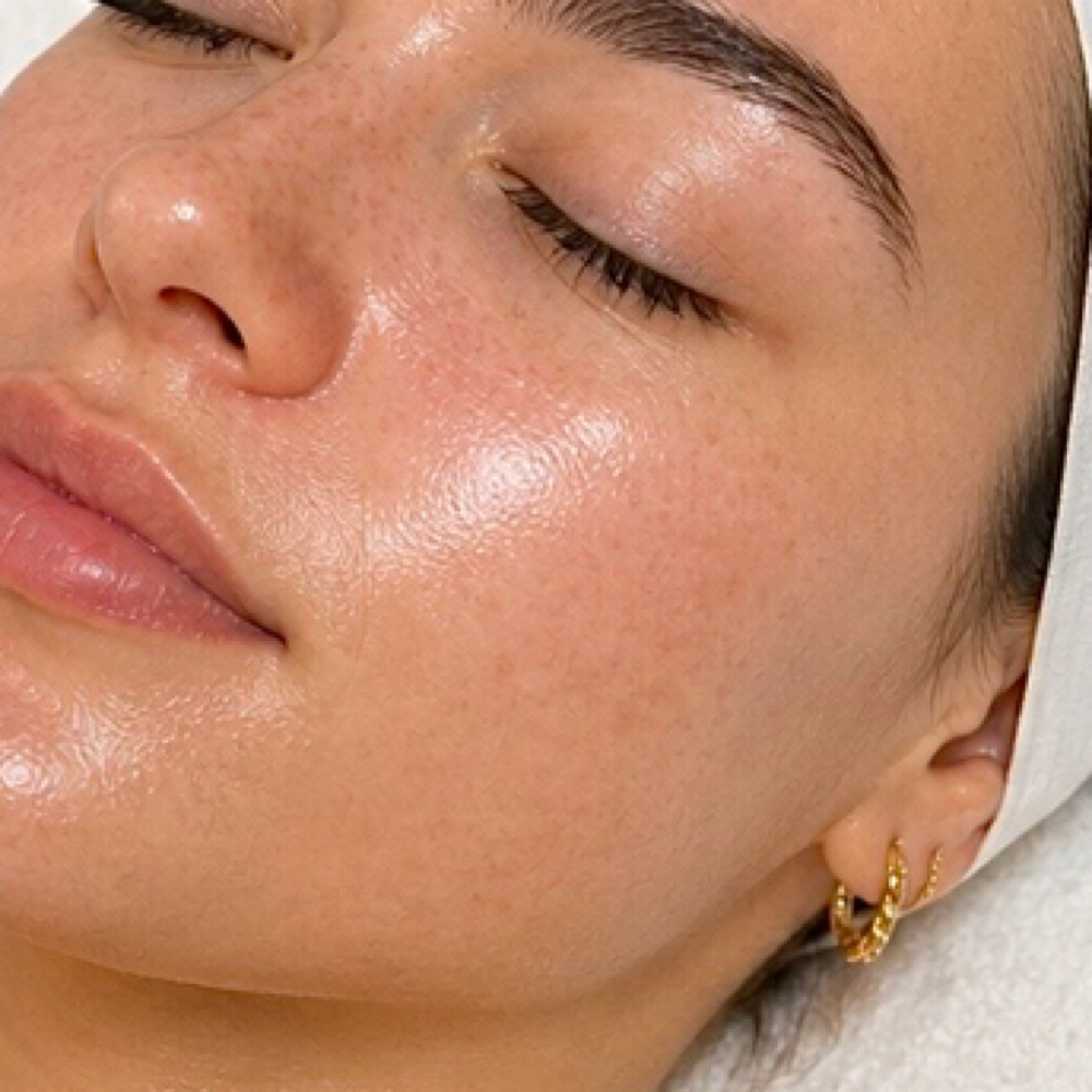 Deluxe HydraGlow Facial at Destiny Aesthetics in Boise, ID