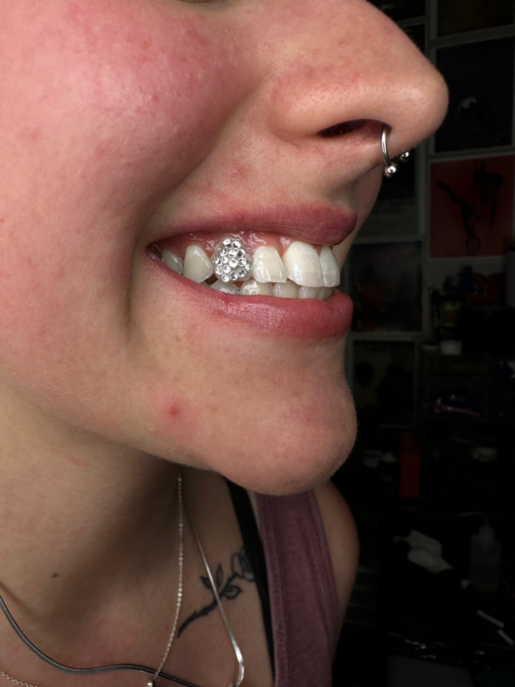 Chandelier/Full Tooth Gem