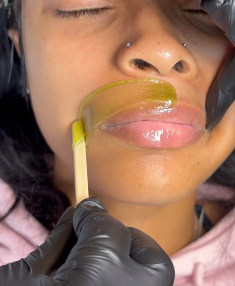 Upper Lip