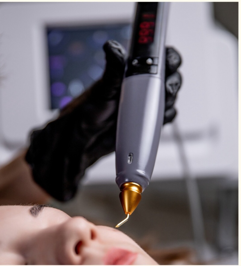Cold plasma full face+neck-rejuvena