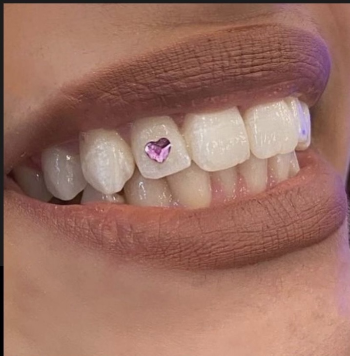 40 Min Teeth Whitening + 1 Gem