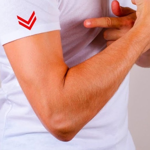 Laser Hair Removal / Arms at Finalé Hair Removal And Skin Care in Minnetonka, MN