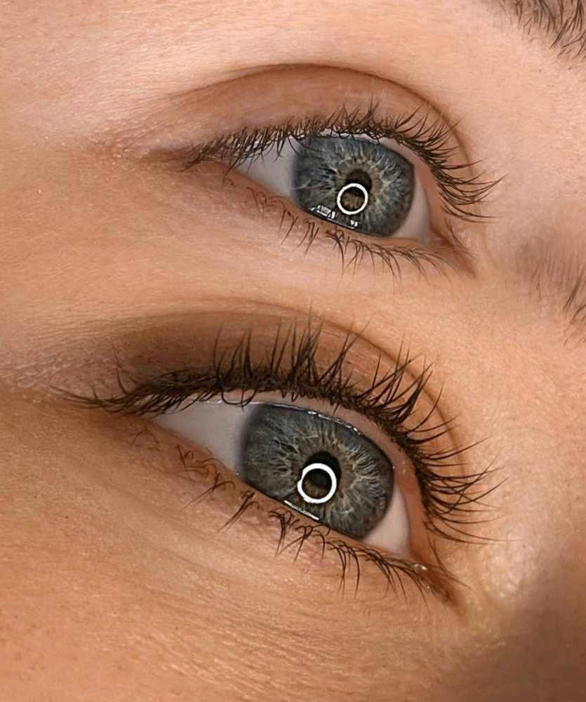 Lash Enhancement