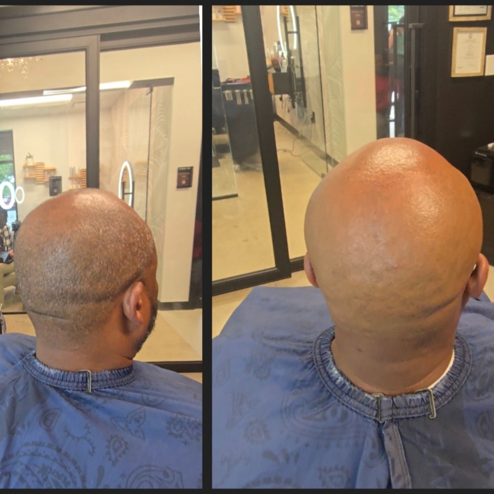 Bald Treatment Experience at The Mane Lounge in Virginia Beach, VA