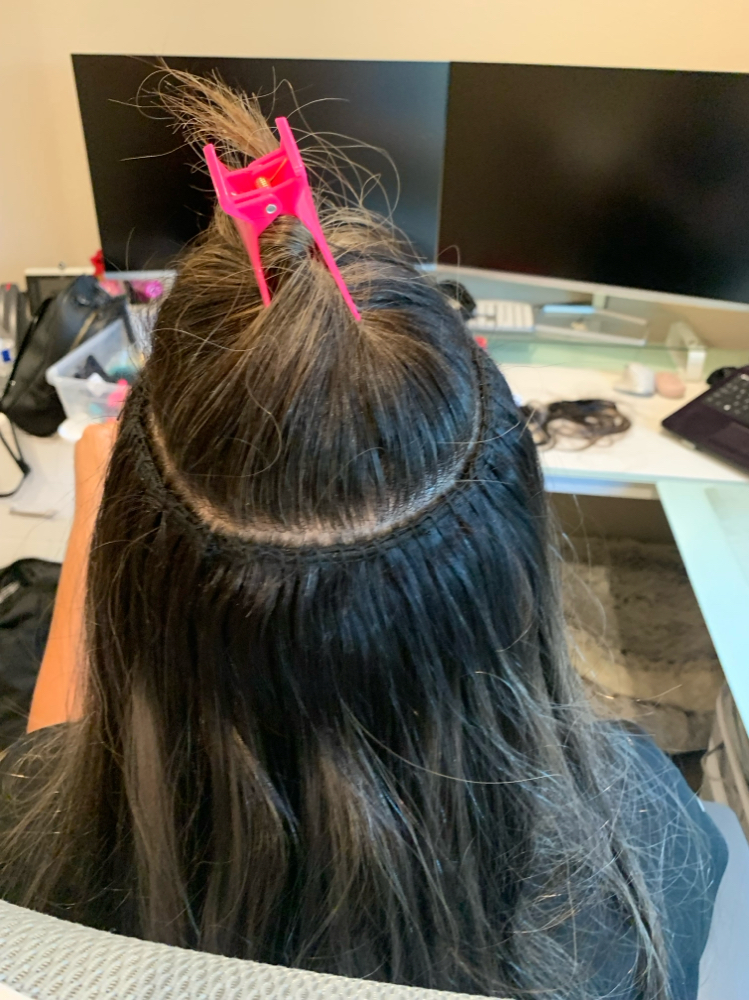 Sewed In Extension Placement