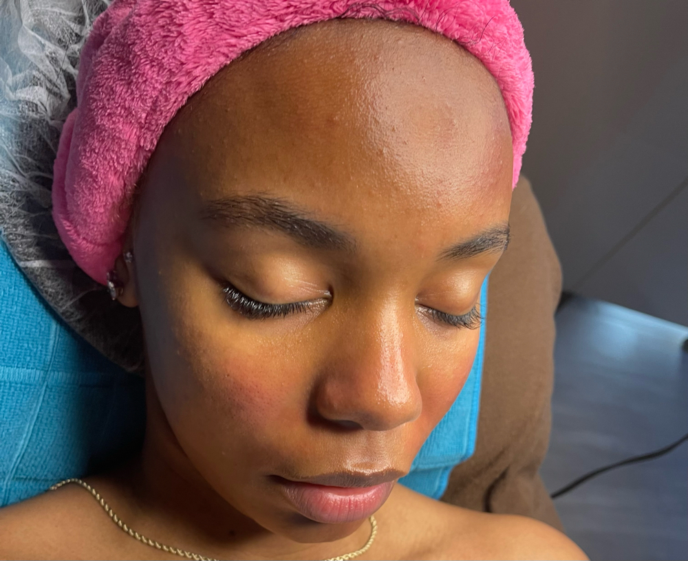 Dermaplaning ADD ON