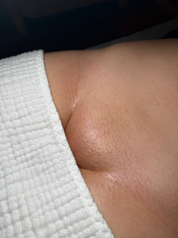 Brazilian at Skin Maintenance in Laurel, MD