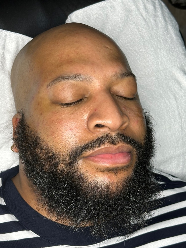 Lympthatic Drainage Massage
