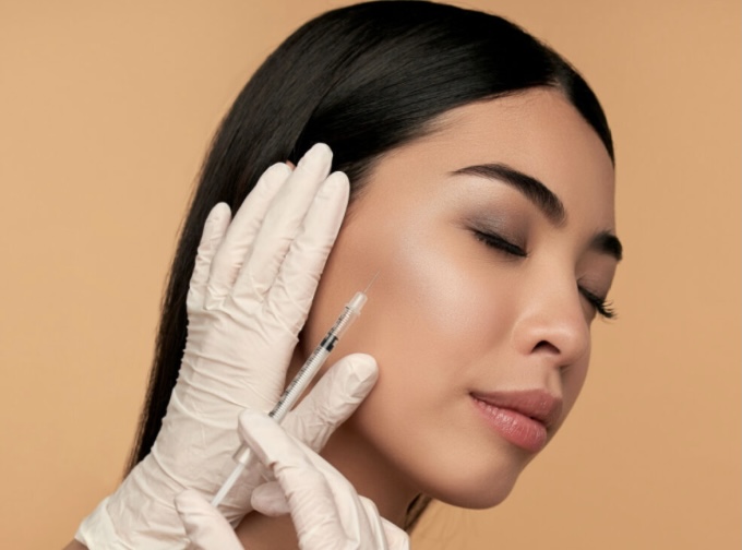 Cheeks/Hands Filler: Radiesse