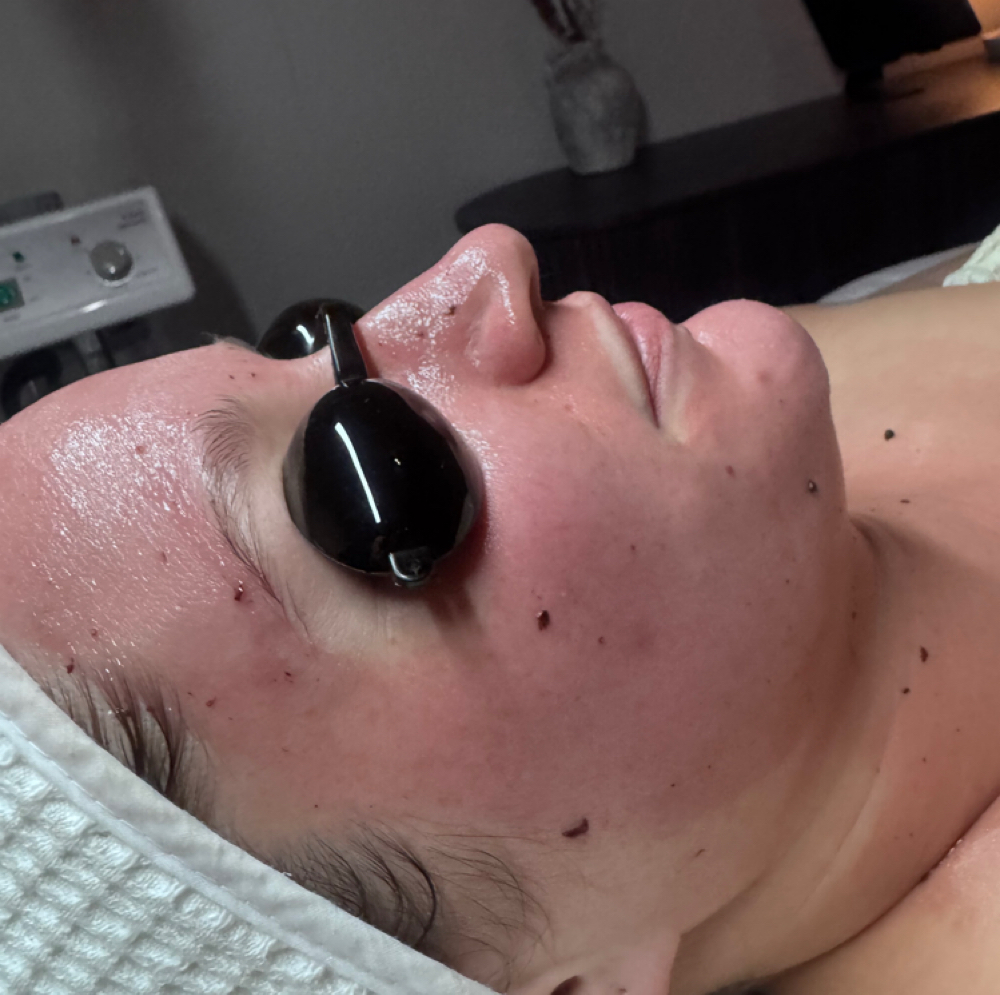 The Blueberry Firming Treatment at Jessica Serna Skincare in Modesto, CA