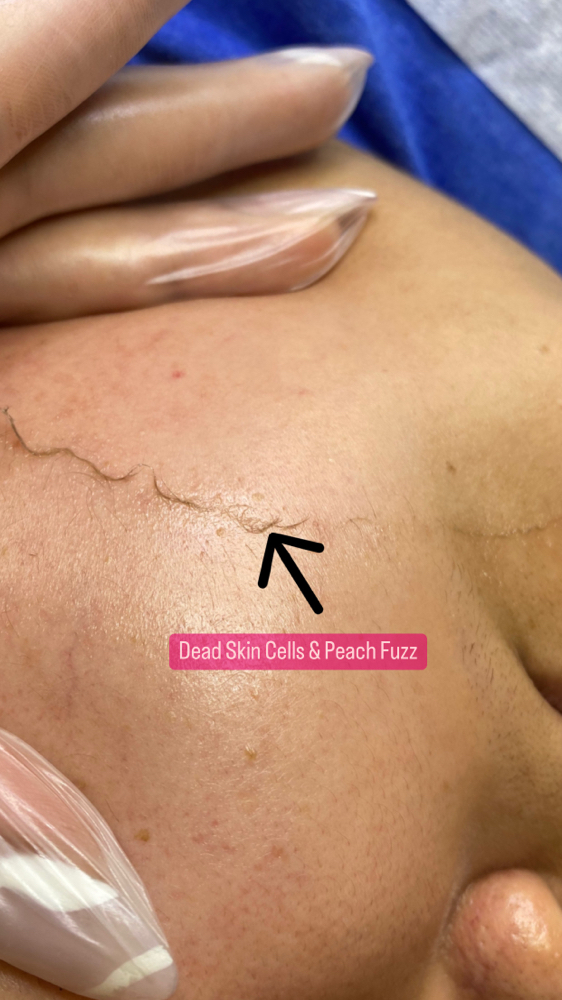 Dermaplane/Basic Facial