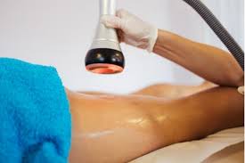 Cellulite Reduction/ Leg smoothing