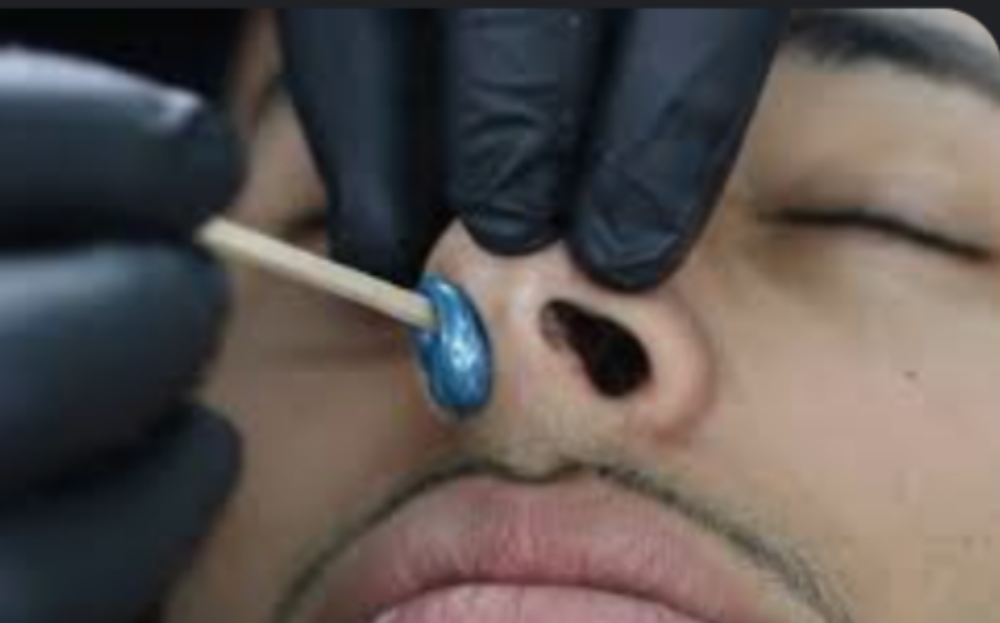 Nostrils