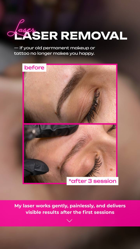 Laser Removal PMU at Madame L Beauty Studio in Downers Grove, IL