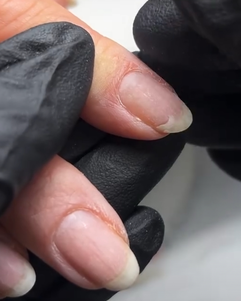 Nail Repair at Serene Studio Oviedo in Oviedo, FL