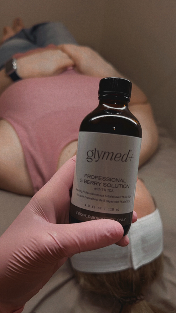 5 Berry Chemical Peel