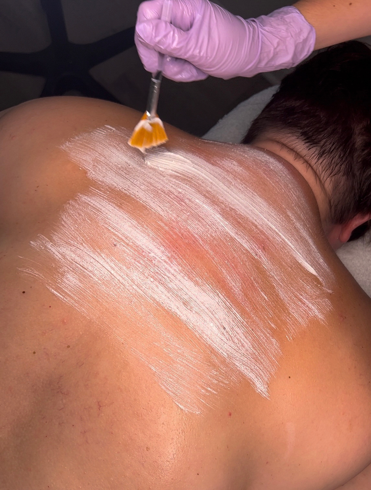 Back-ne Facial