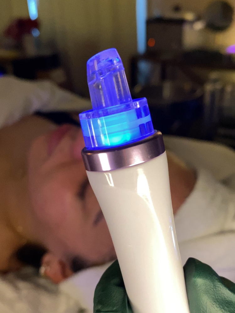 Prima Hydrodem Facial