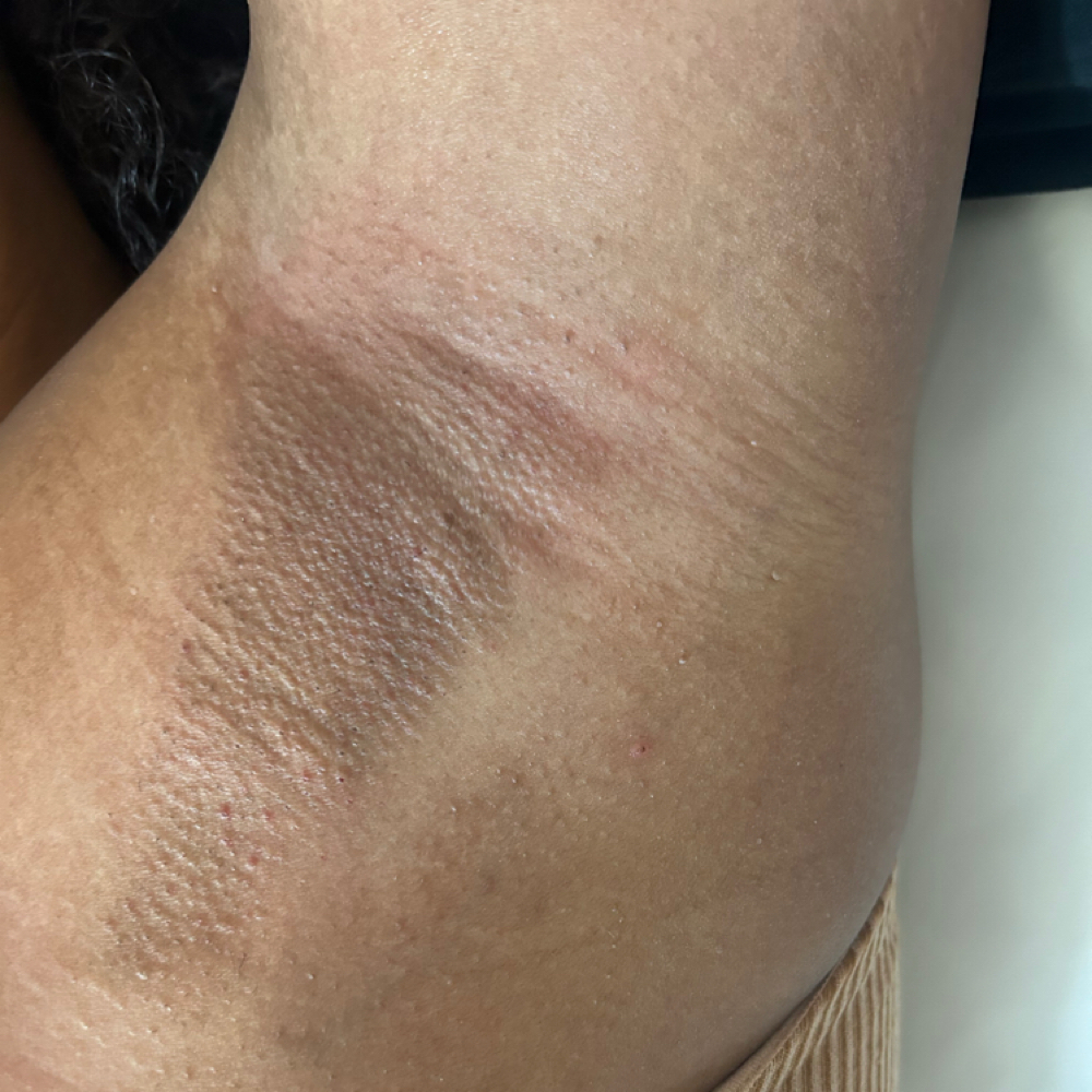 Underarm Wax at Enhanced Skyn Lounge in Hampton, VA