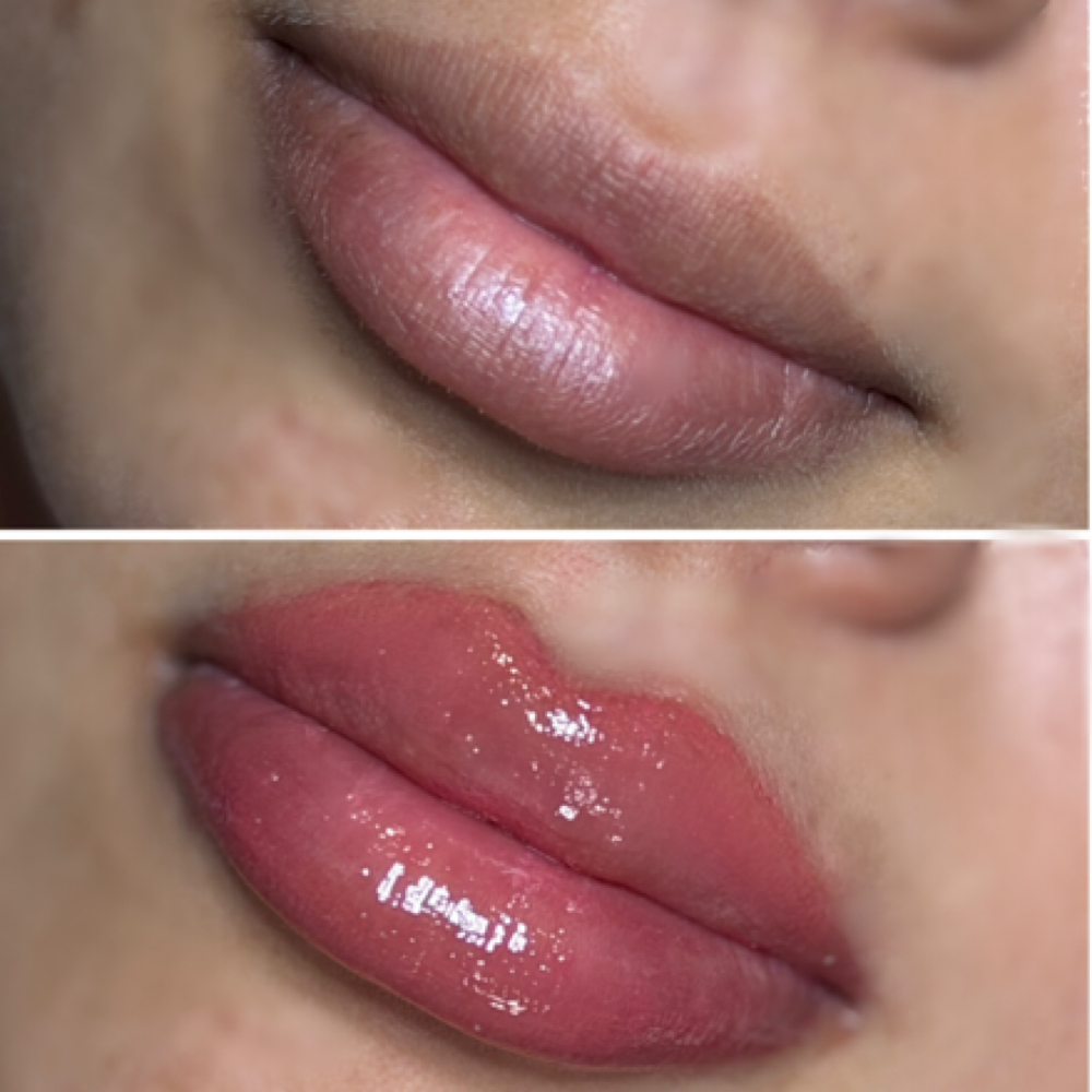 Lip Blushing at Infinity Aesthetics in Elsa, TX