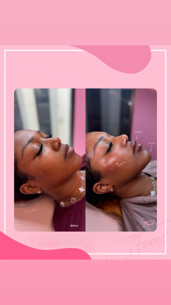 The Natural Package