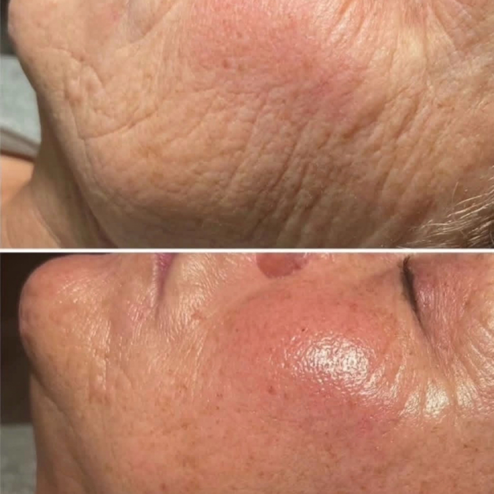 Reverse Aging Facial at Lashed by Nat in Middletown, NY