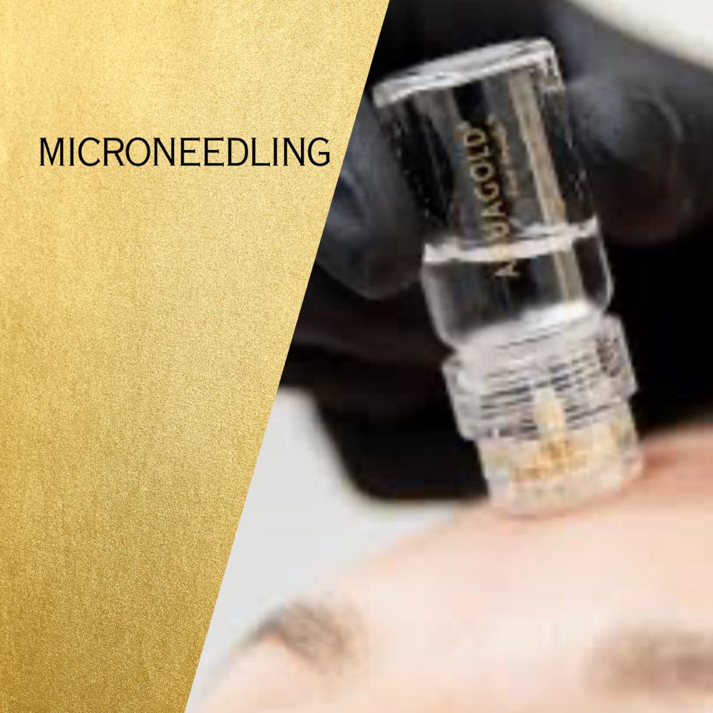 Microneedling with Vitamins