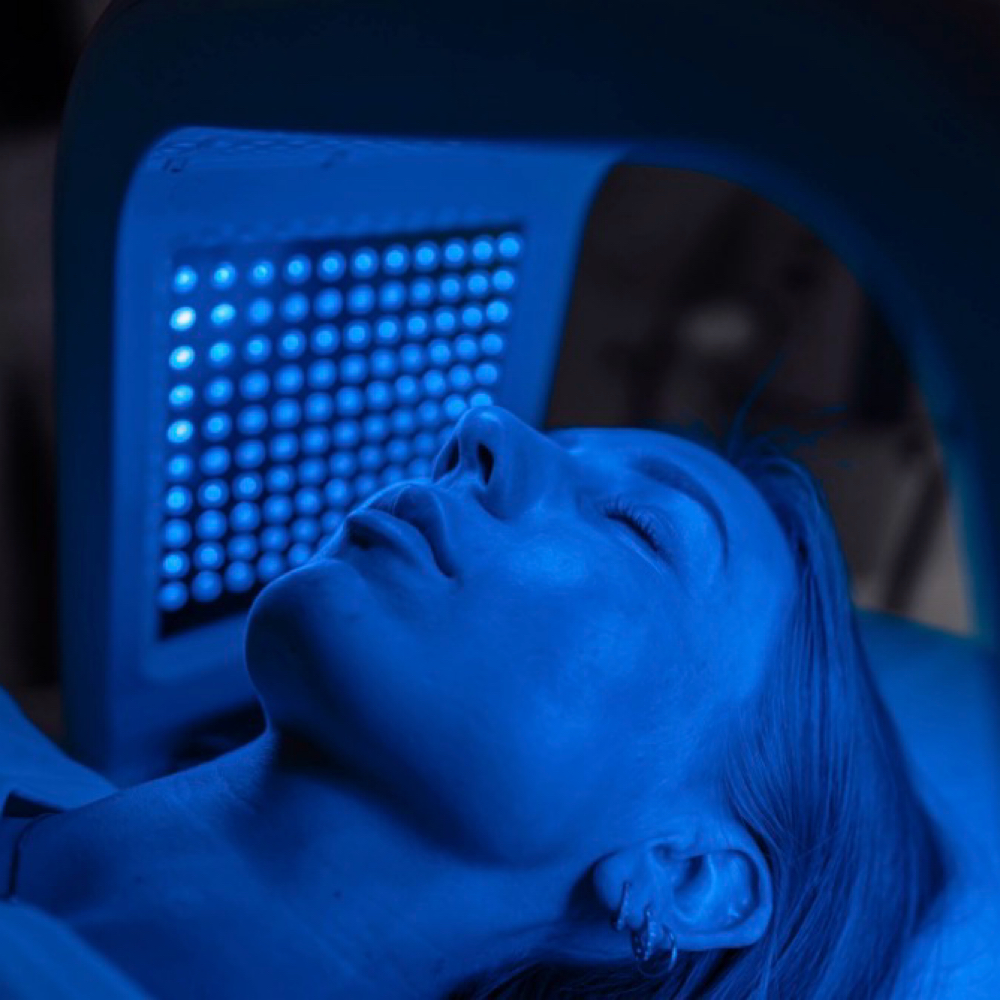 Acne Defense | Blue LED Therapy🔵