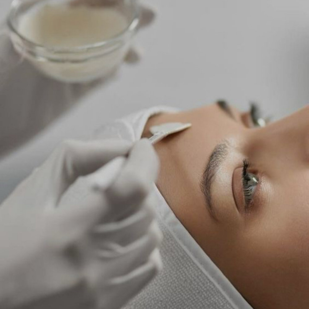 Chemical Peel Facial at Wild Lily Esthetics in Richmond, KY