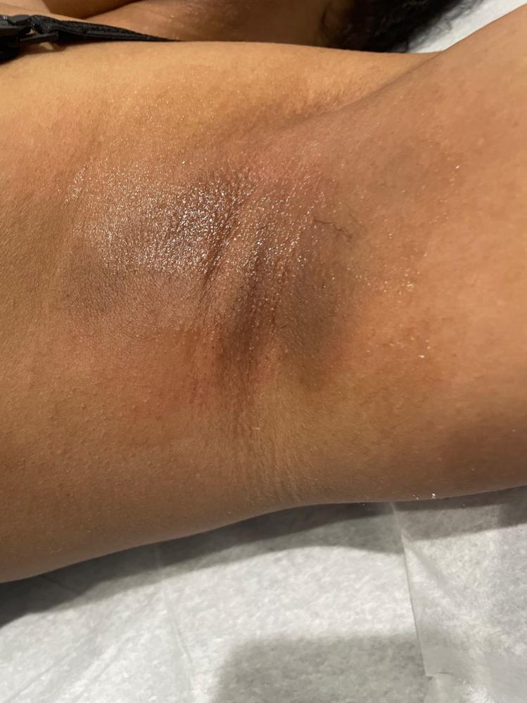 Under arm wax