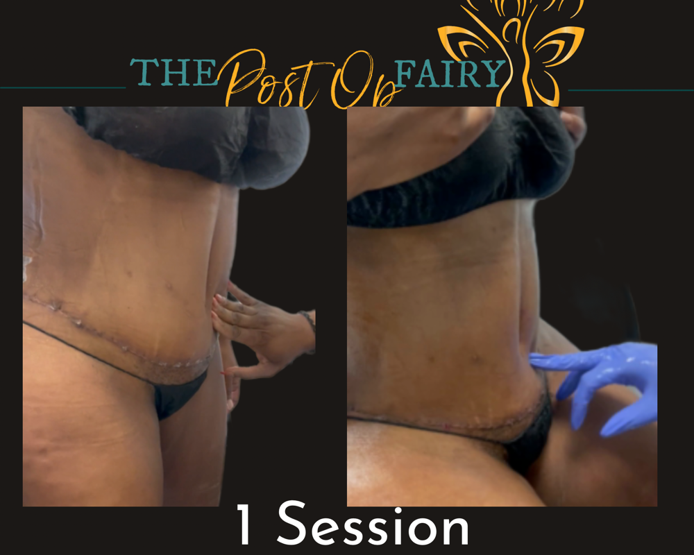 Individual Session W/ Fluid Removal