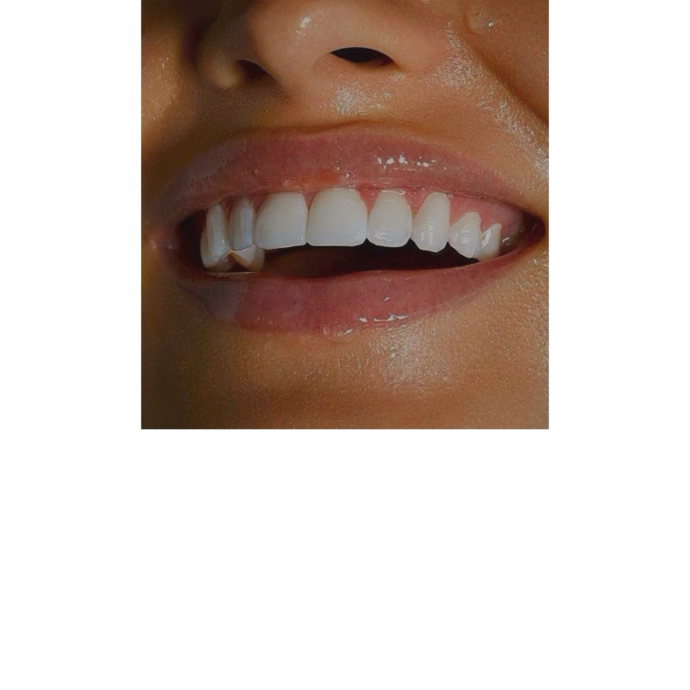 SmileShine Strips