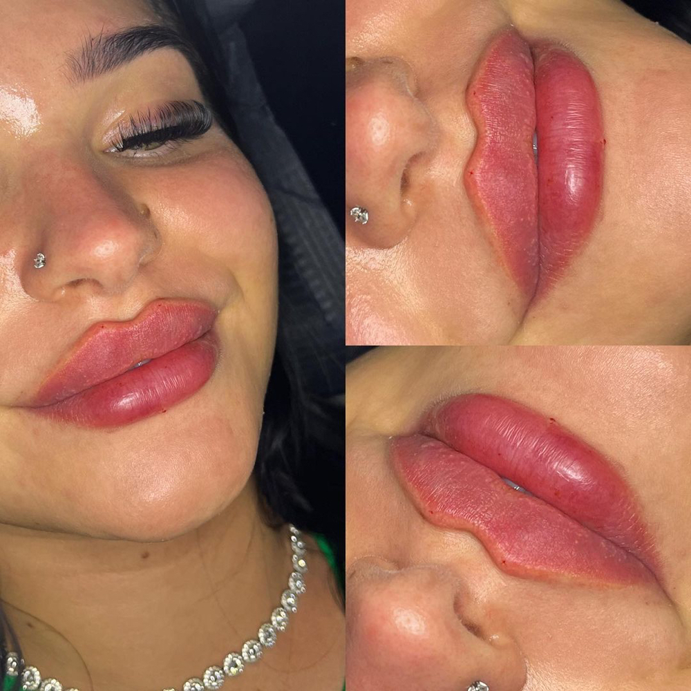 Russian Lips Technique