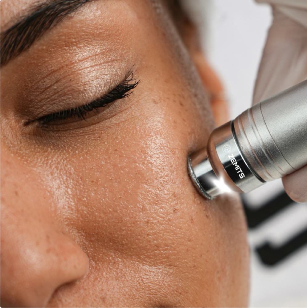 Signature HydroDiamond Facial at Lo Lo Beauty Co in Byron Center, MI