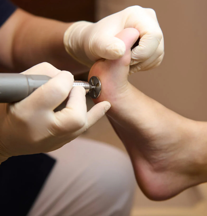 Dry Pedicure at Aloco. in Fort Myers, FL