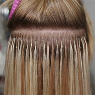 Fusion Extensions- Partial
