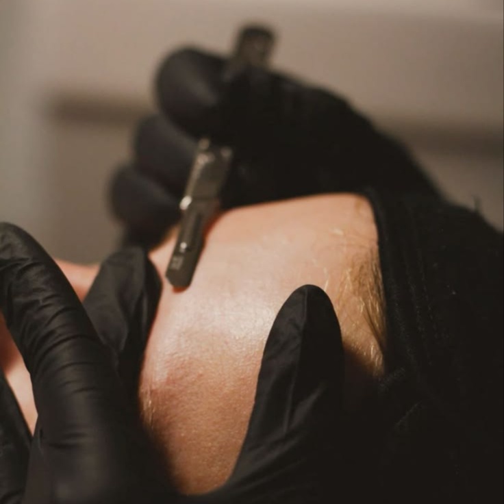 Dermaplaning at KC Custom Beauty in Whitney Point, NY