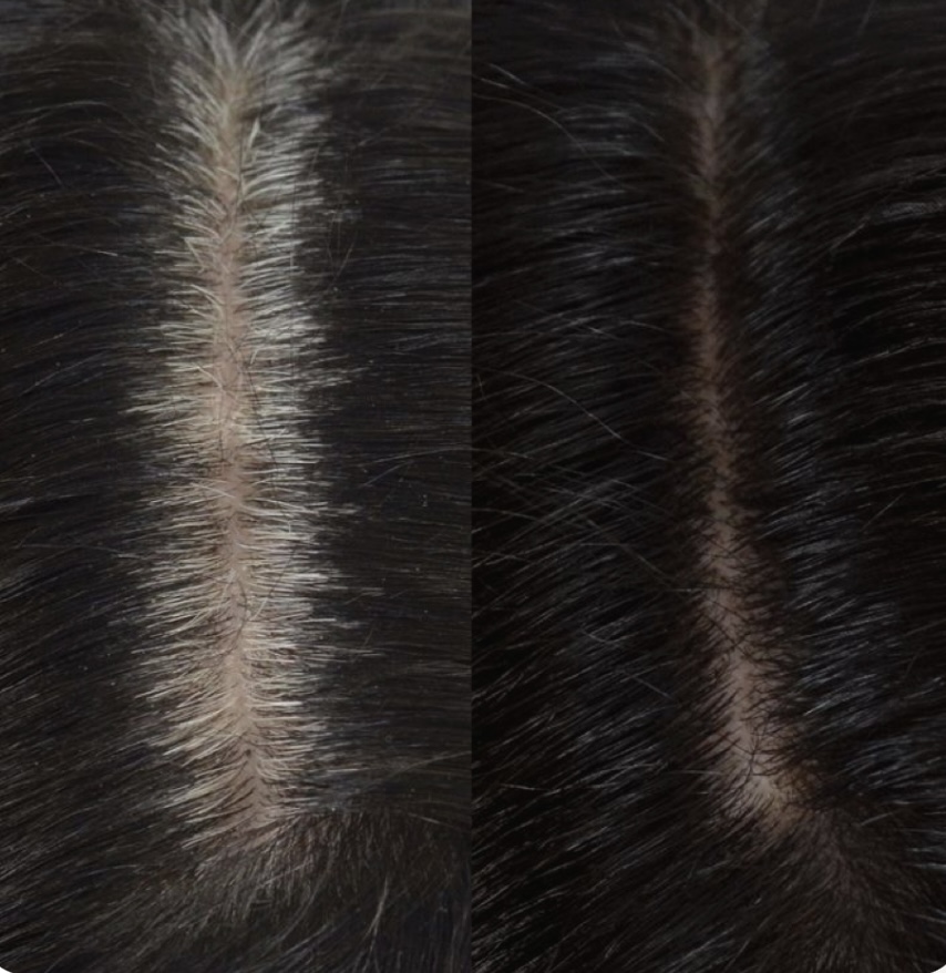 Root Touch Up
