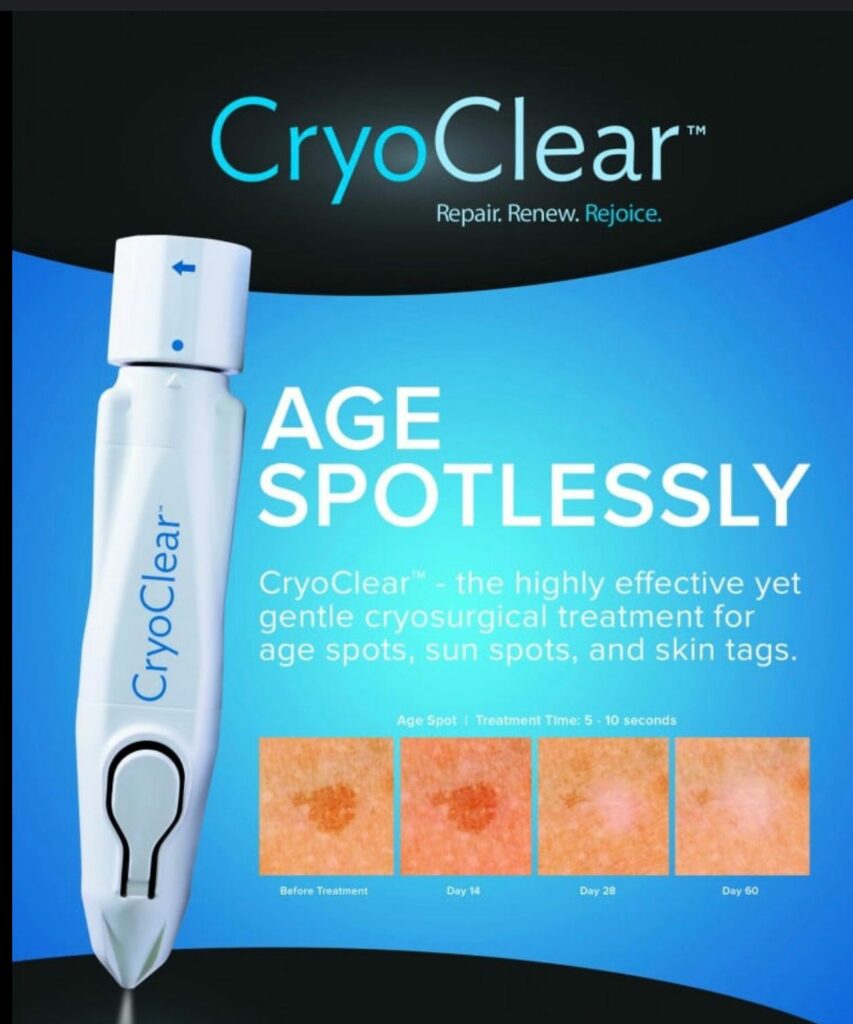 Cryo-clear for spot/tags $50+