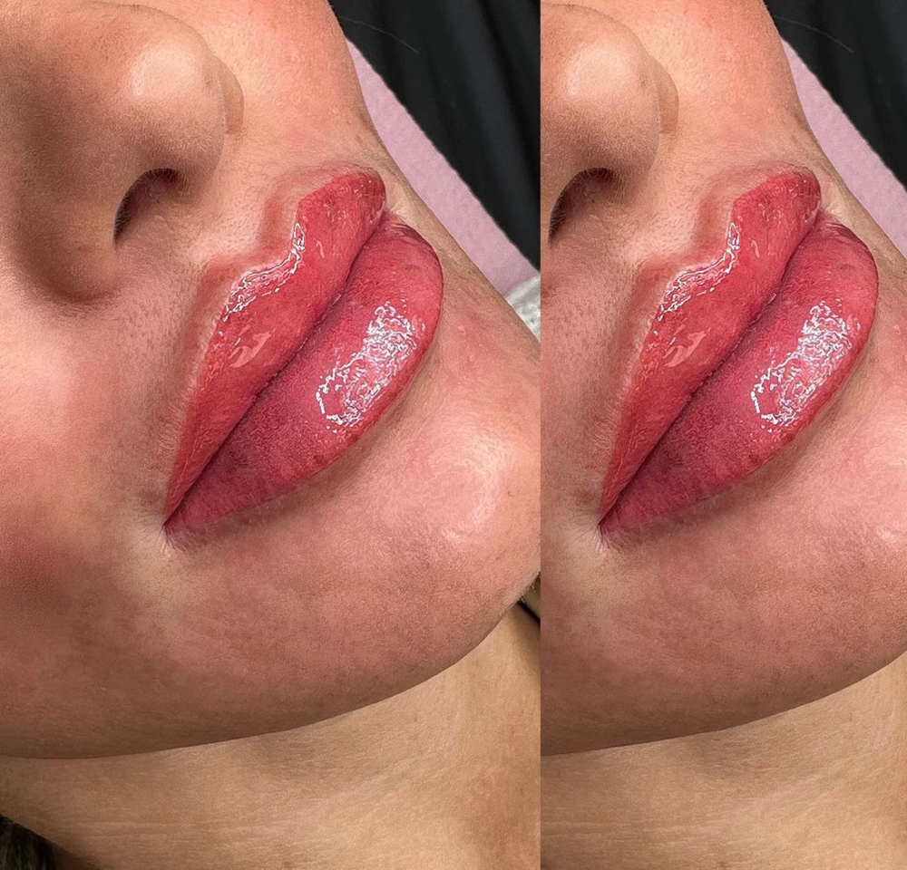 Custom Lip Blushing