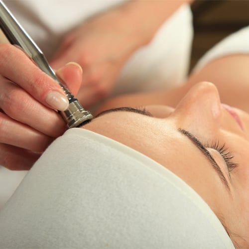 Microdermabrasion Facial