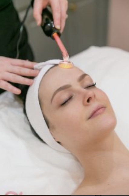 Acne Facial