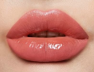 Lip Fillers  Call 469-626-2156