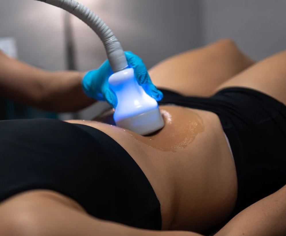 Cryotherapy Body Sculpting
