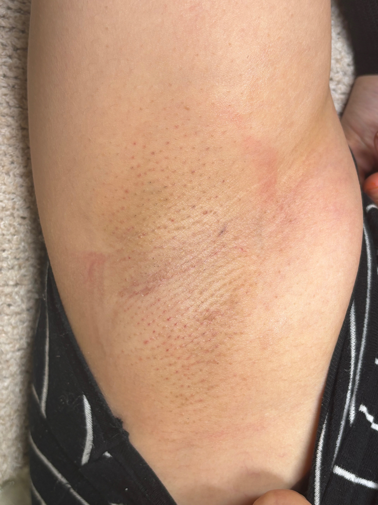 Under arm wax