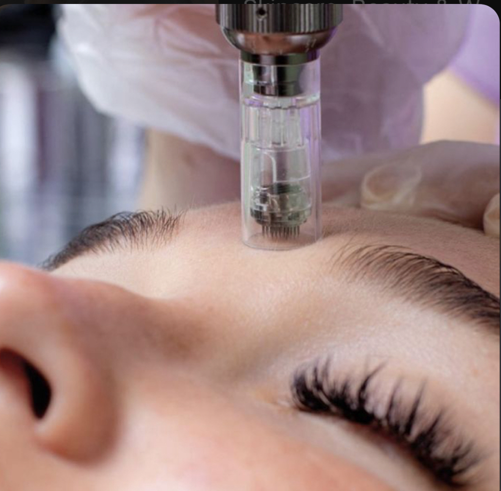 Flawless Fusion Microneedling