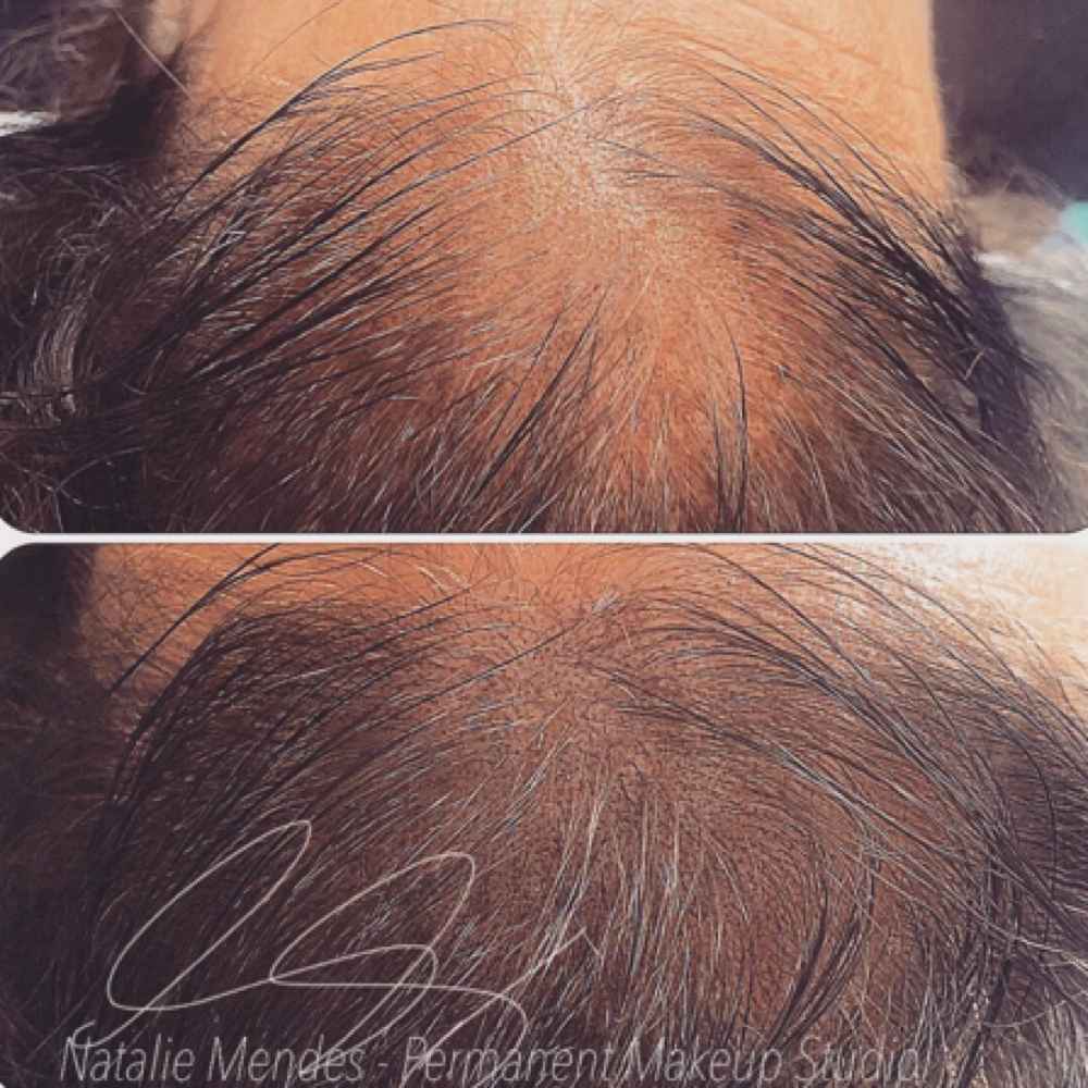 Micro Scalp Pigmentation at Cosmetic Artistry in Lancaster, CA