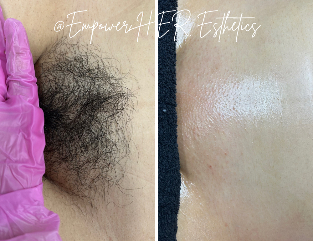 Reg Client-Brazilian Wax at Empower Her Esthetics LLC in Oklahoma City, OK
