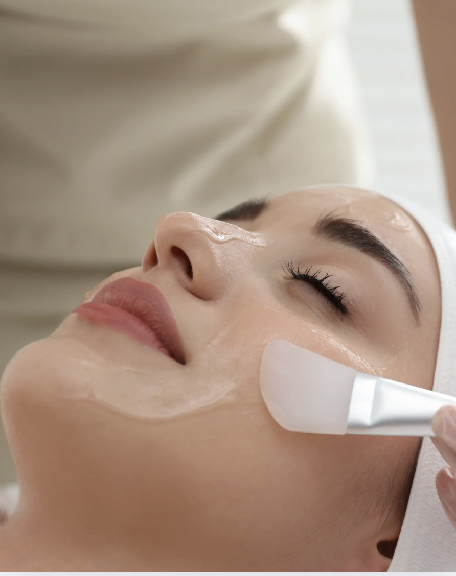 Chemical Peel